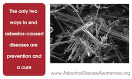 Texas Mesothelioma Lawyer Archives Dubose Law Firm Pllc