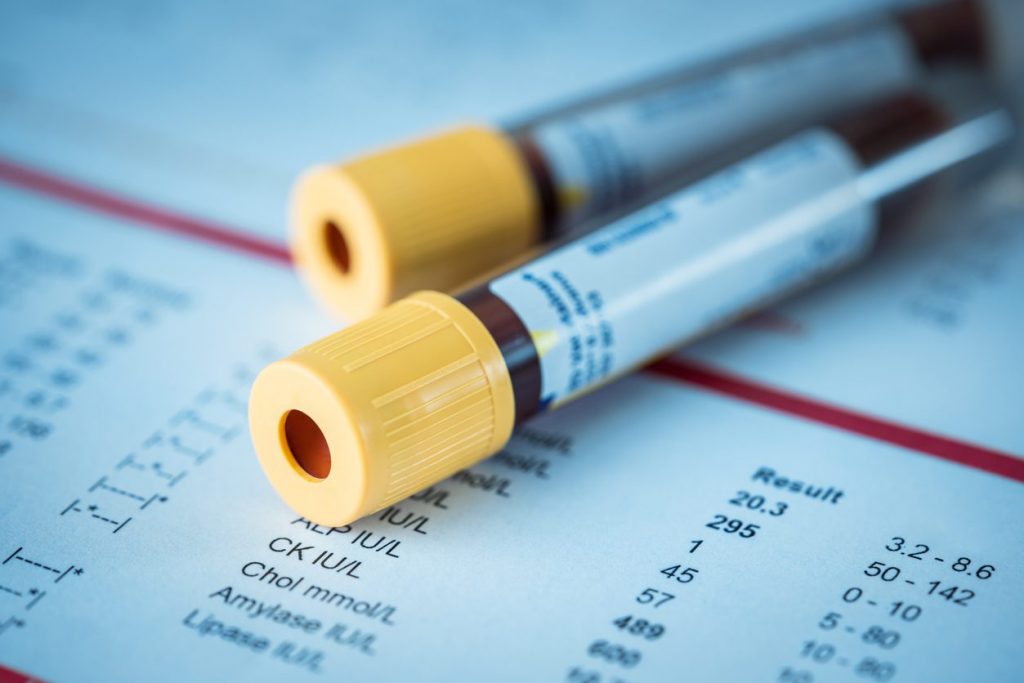 Lung Cancer blood test