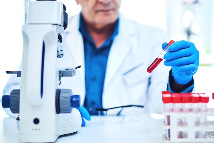 innovative blood test for mesothelioma detection using chromosomal rearrangements.