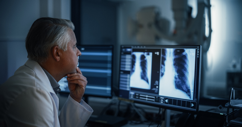physician examining low-dose CT scan results for early lung cancer detection