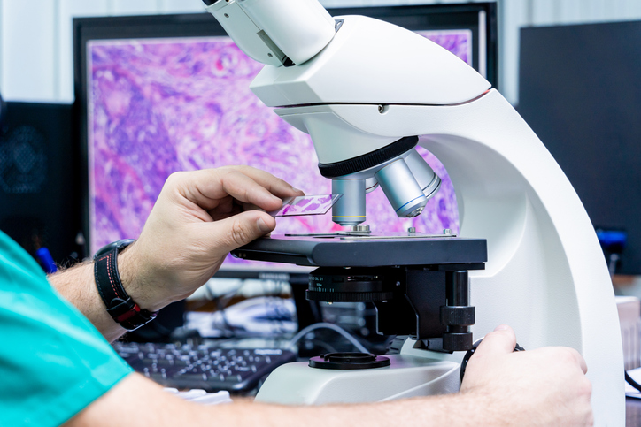 Pathologist examining mesothelioma biopsy tissue under a microscope for cancer diagnosis
