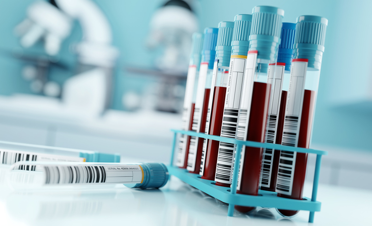 Test tubes filled with blood in a laboratory representing mesothelioma blood test research
