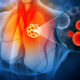 3D illustration of the lungs with a highlighted tumor and a magnified view of cancer cells, representing new mesothelioma treatment research